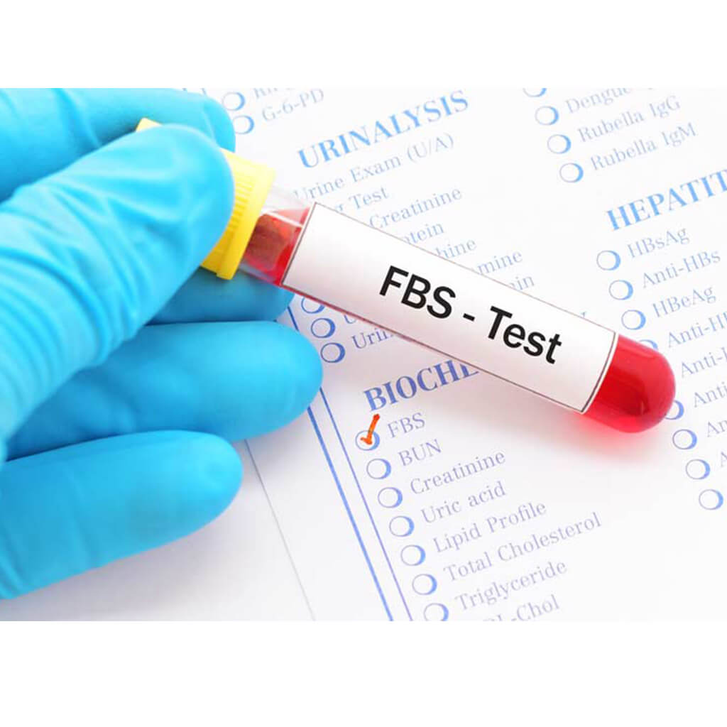 تست قند خون